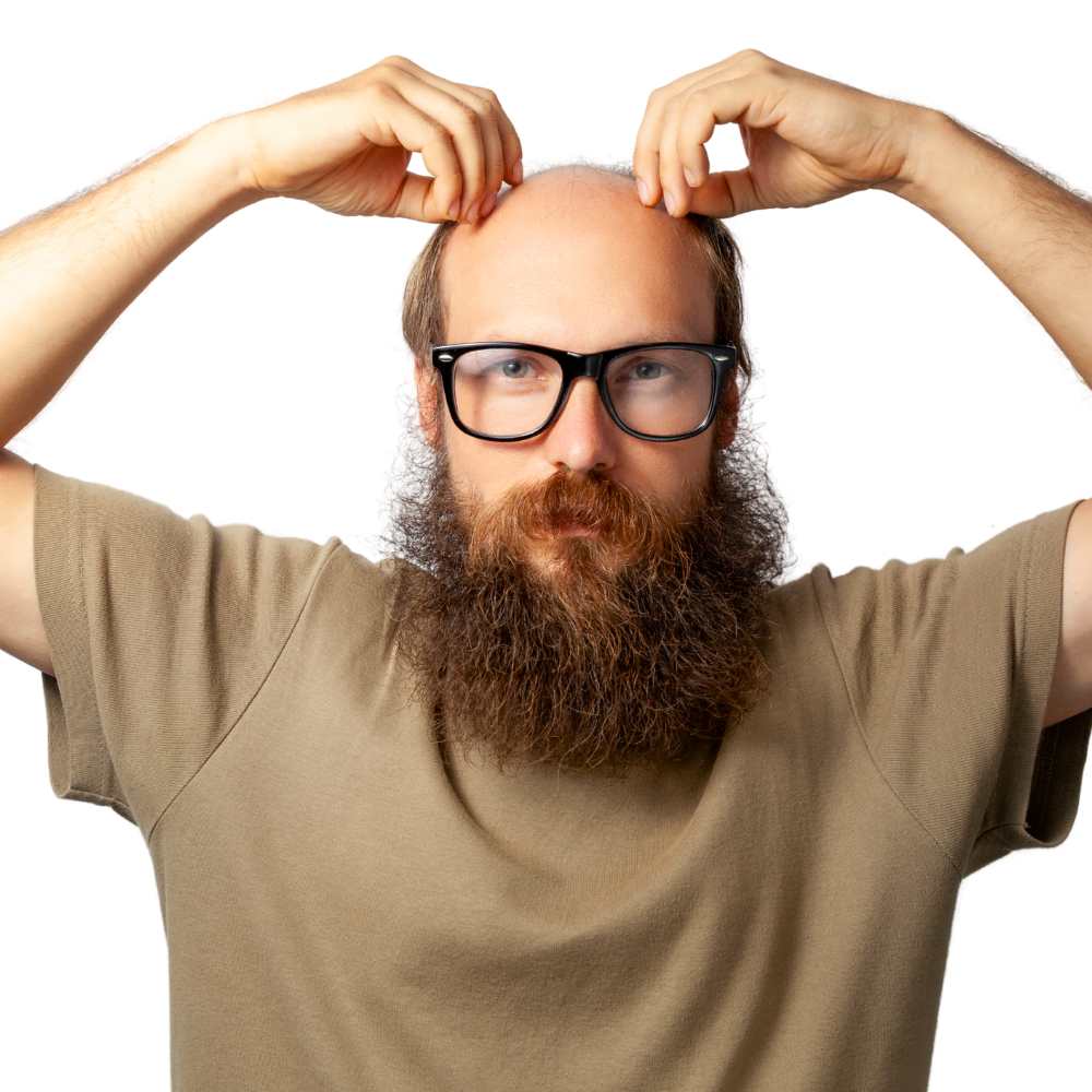 Alopecia